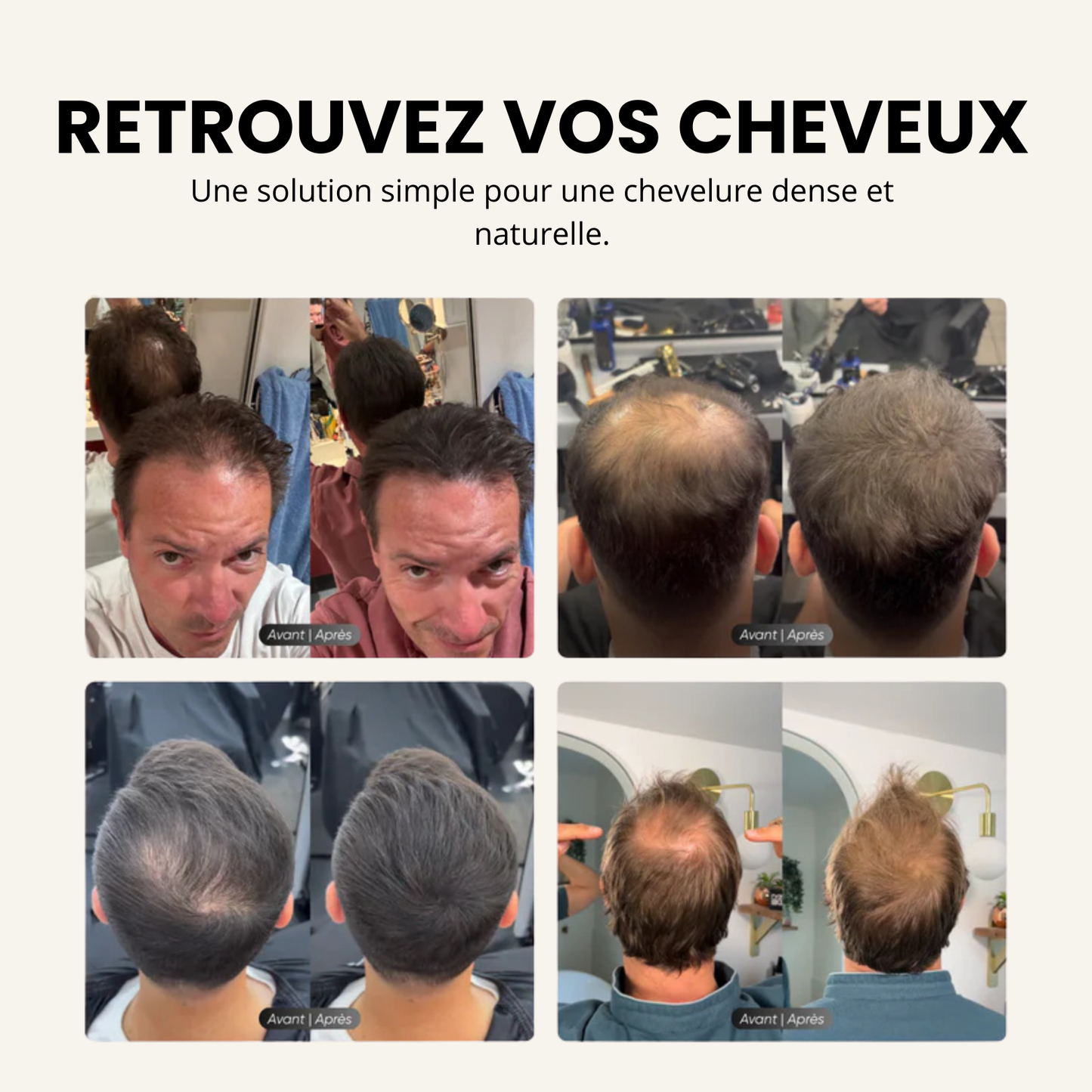 Camouflage capillaire