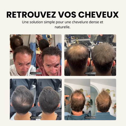 Camouflage capillaire